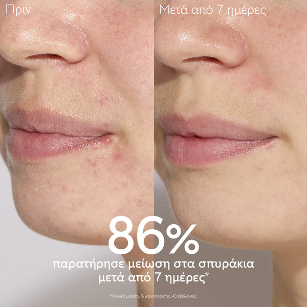 CAUDALIE - VINOPURE Serum Salicylique Anti-Imperfections - 30ml